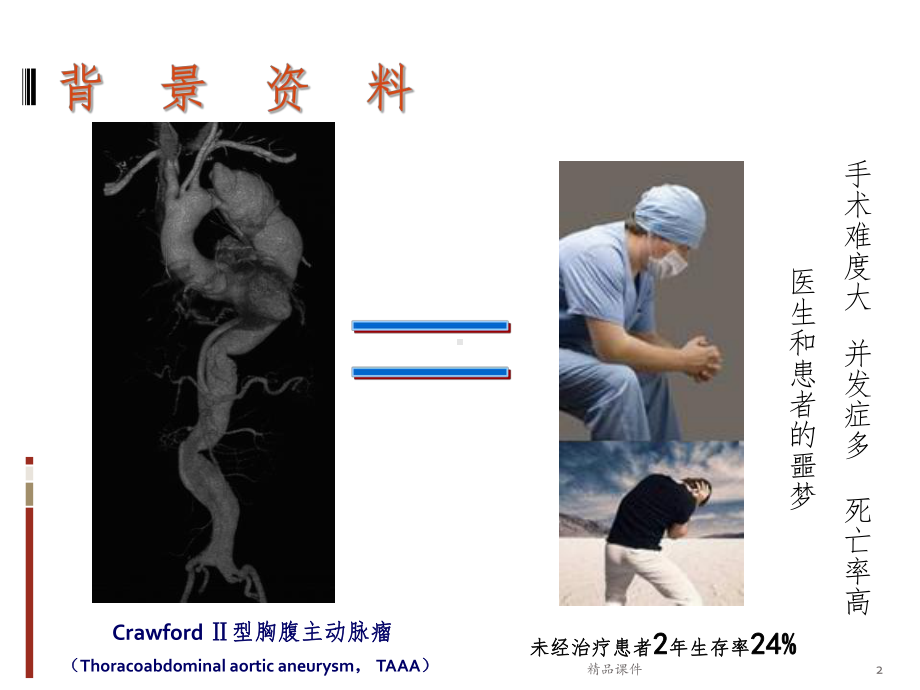 常温胸腹主动脉替换课件.ppt_第2页