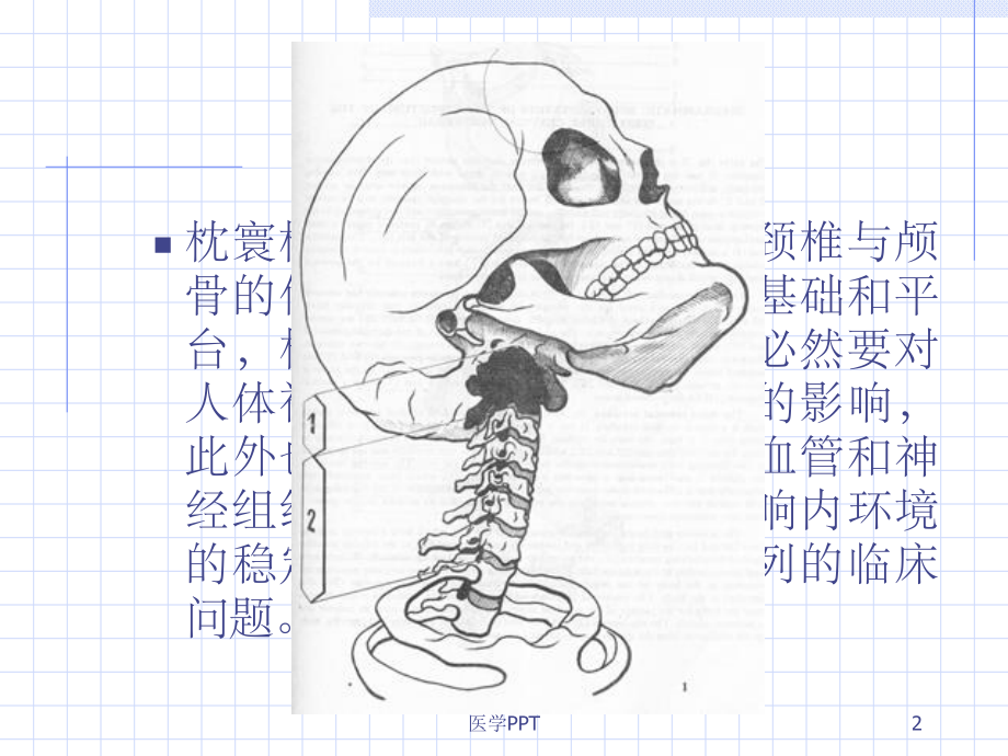 枕寰枢复合关节疾病推拿治疗课件.ppt_第2页