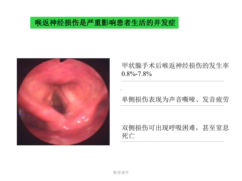 甲状腺术中喉返神经损伤的原因及教训课件.ppt_第2页