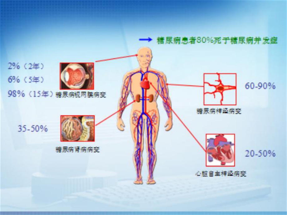 对糖尿病周围神经病变修改课件.pptx_第3页