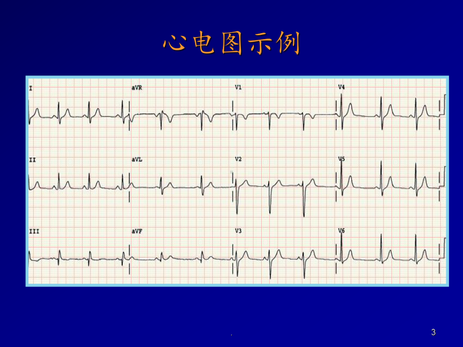 心电图诊断课件整理.ppt_第3页