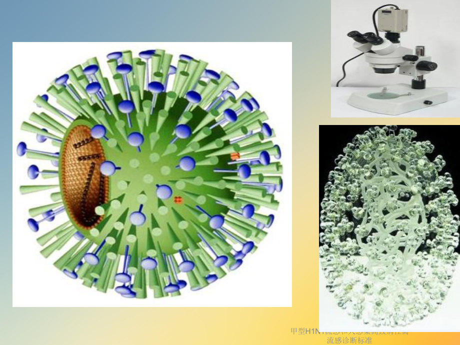 甲型H1N1流感和人感染高致病性禽流感诊断标准课件.ppt_第2页