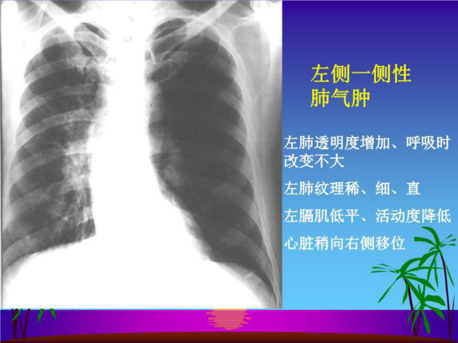 最新呼吸系统2课件.ppt_第3页