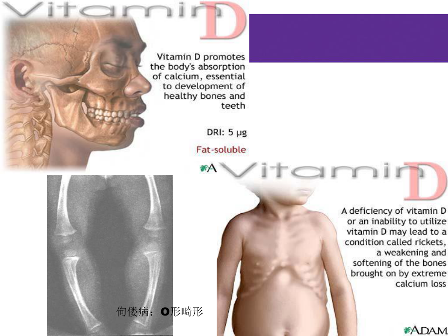 活性维生素D在CKD继发性甲旁亢中的合理应用培训课件.pptx_第3页