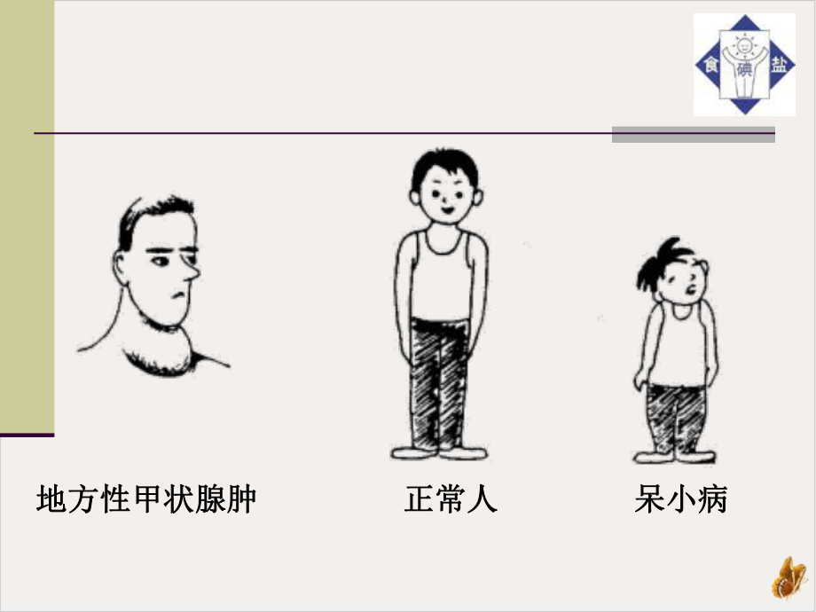 甲状腺胰岛素实用课件.pptx_第2页