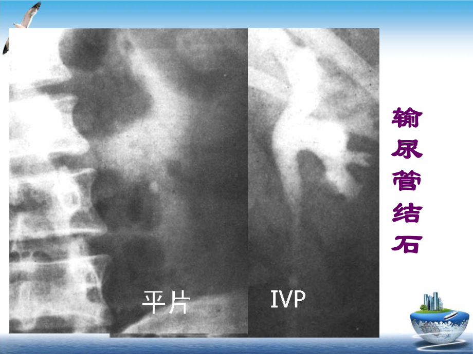 泌尿系统影像诊断第三部分课件.pptx_第2页