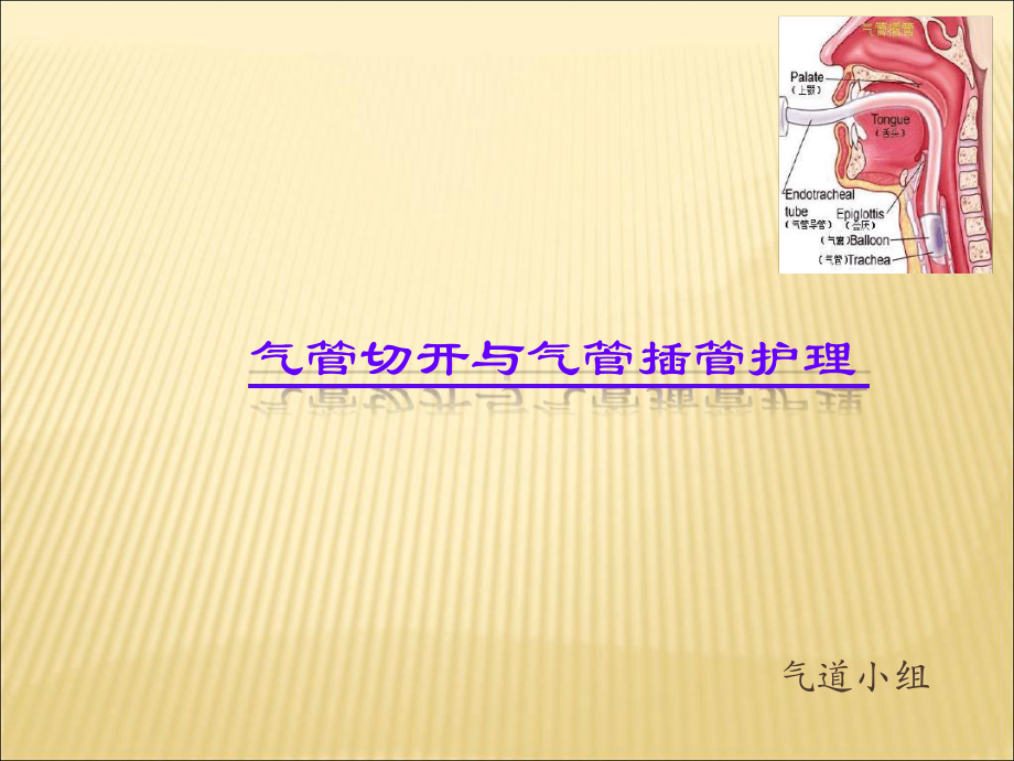 气管切开与气管插管护理课件.ppt_第1页