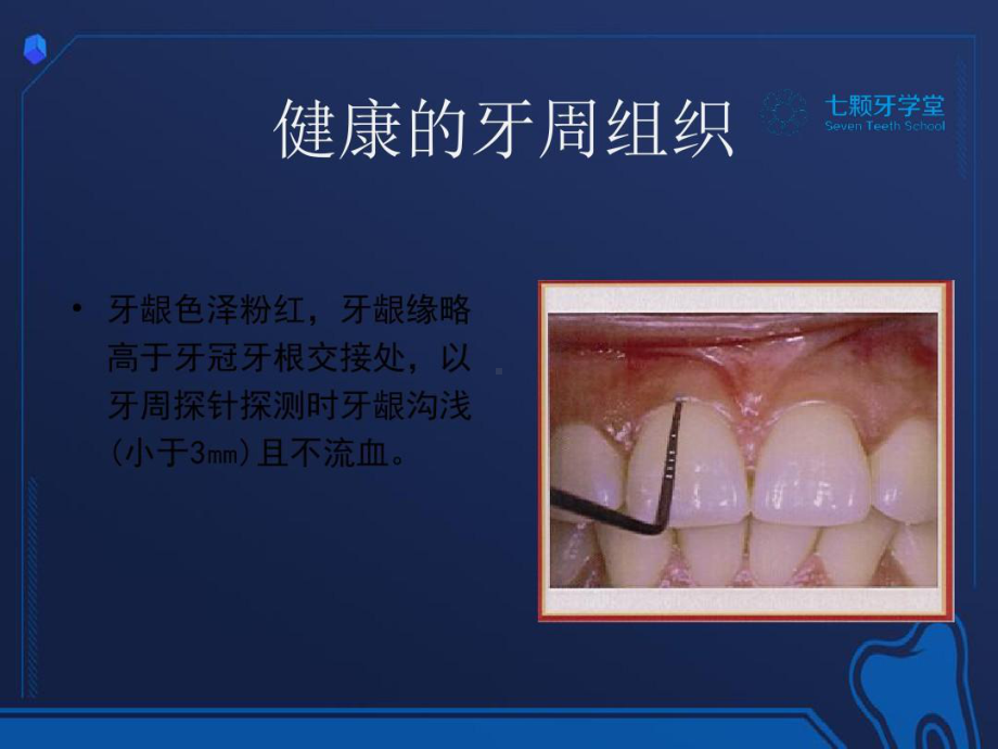 牙科宣教-牙周病课件.ppt_第2页