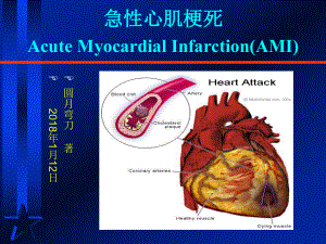 急性心肌梗死临床诊断与治疗(同名668)课件.ppt