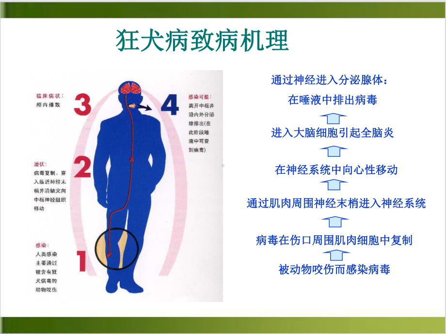 狂犬病暴露后处理研究课件.pptx_第3页