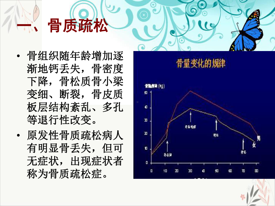 椎体成形术在骨质疏松性椎体压缩骨折中的应用课件.pptx_第2页