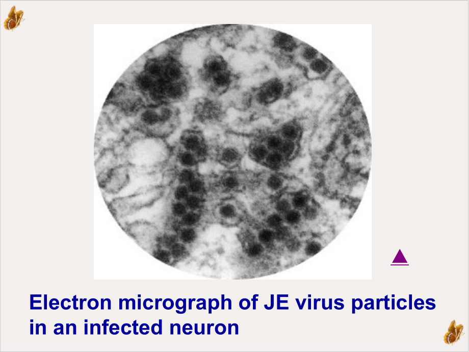 流行性乙型脑炎课程课件.pptx_第3页