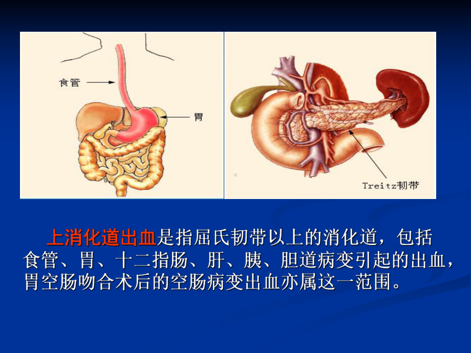 消化道出血护理-查房(带病例)课件.ppt_第3页