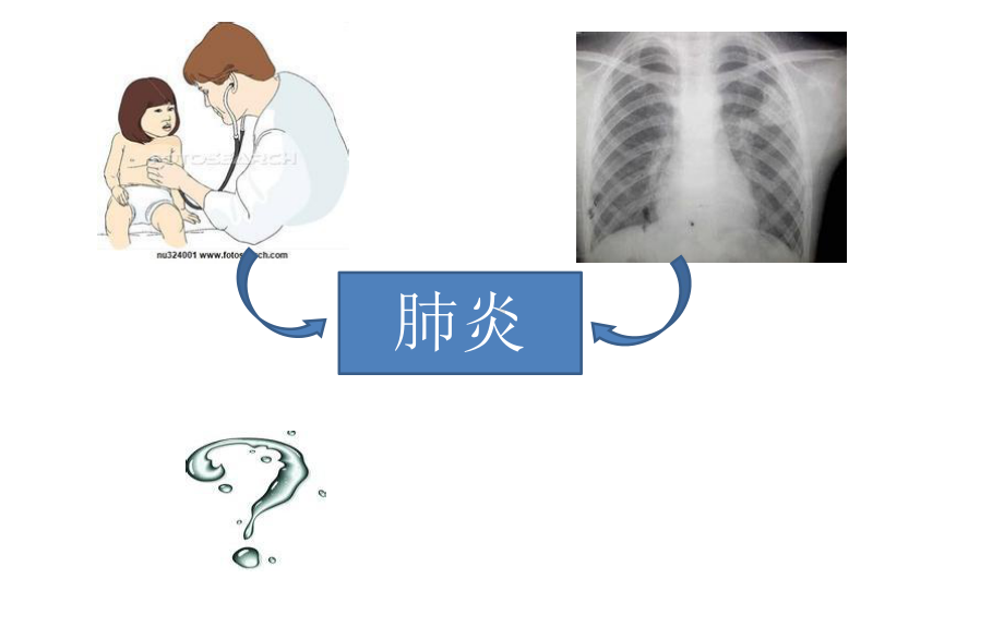 最新从指南更新看非典型病原体地位课件.ppt_第2页