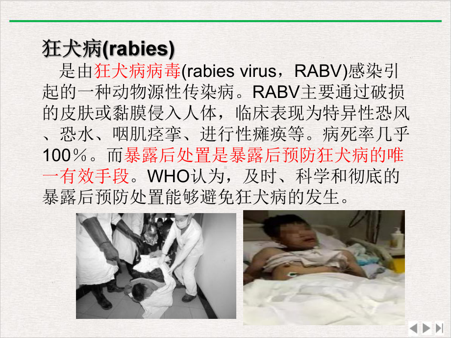 狂犬病暴露后急诊处置新版课件.pptx_第1页