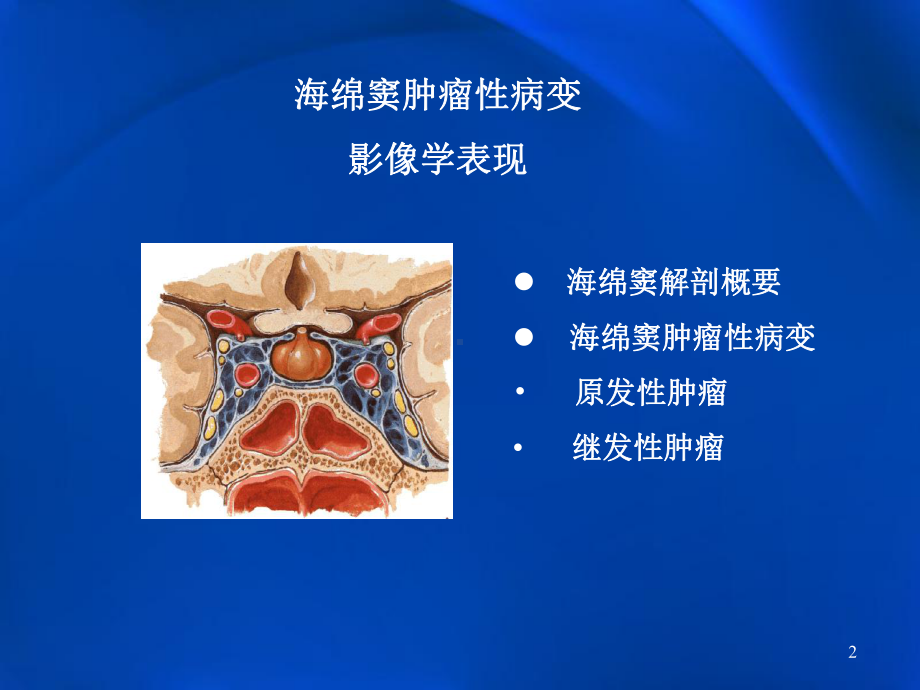 海绵窦肿瘤性病变影像学表现课件.ppt_第2页