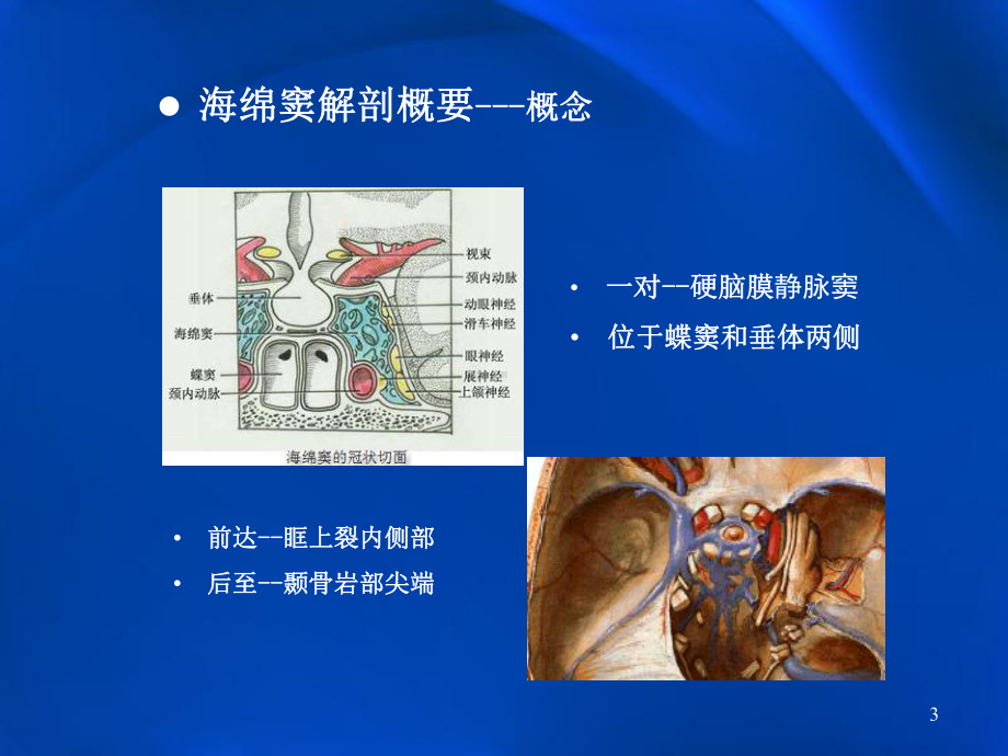 海绵窦肿瘤性病变影像学表现课件.ppt_第3页