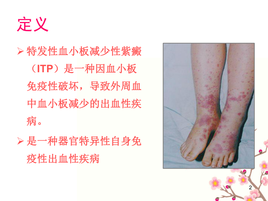 特发性血小板减少性紫癜(ITP)课件.ppt_第2页