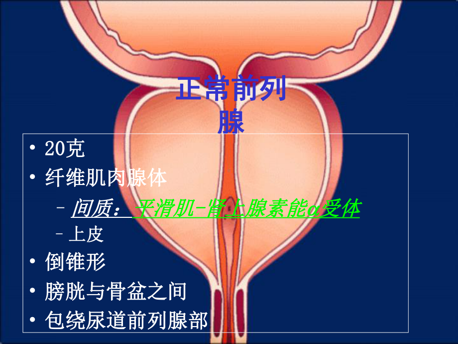 泌尿系统梗阻新课件.pptx_第2页