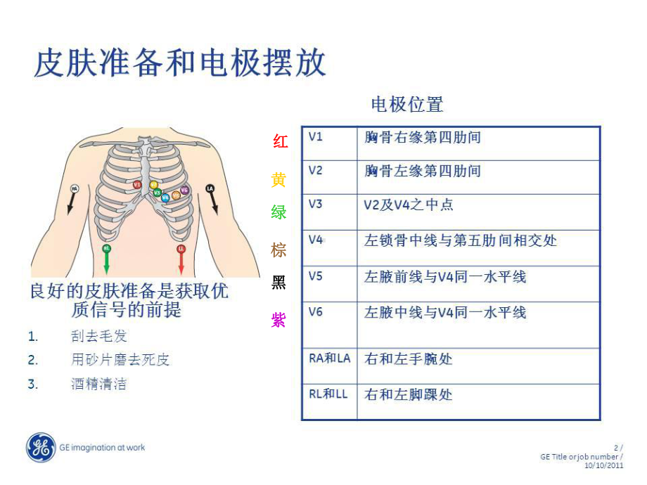 常见心律失常的识别与处理-课件.ppt_第3页