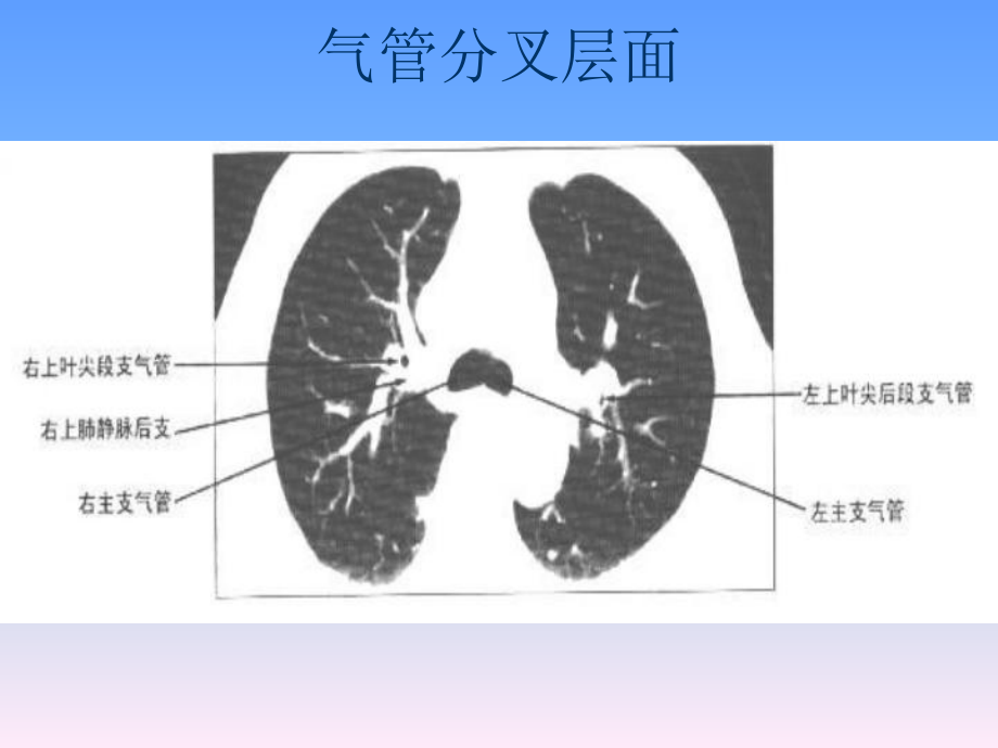 正常胸部CT解剖-课件.ppt_第2页