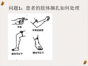 毒蛇咬伤的外科局部治疗教学课件.pptx