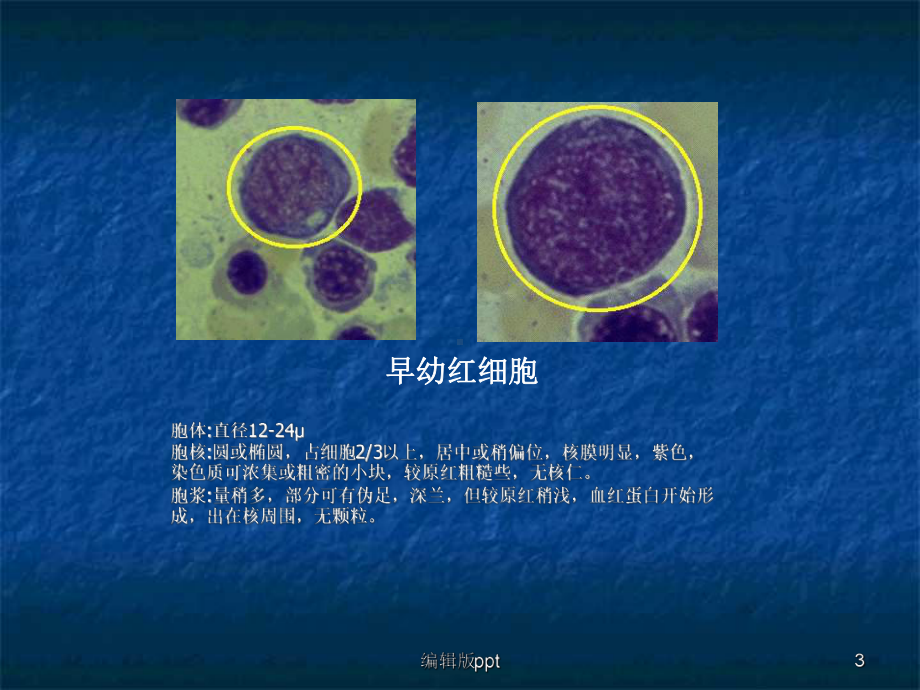 常见血液学课件.ppt_第3页