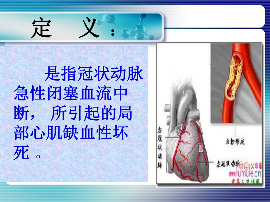 急性心肌梗死抢救配合与护理课件.ppt_第3页