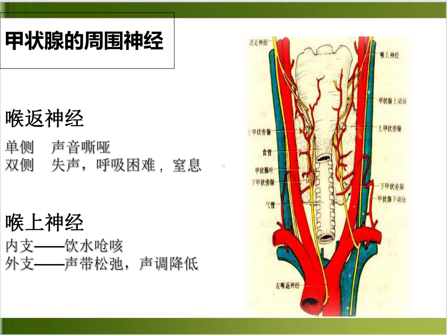 甲状腺肿瘤护理查房优质课件.ppt_第3页