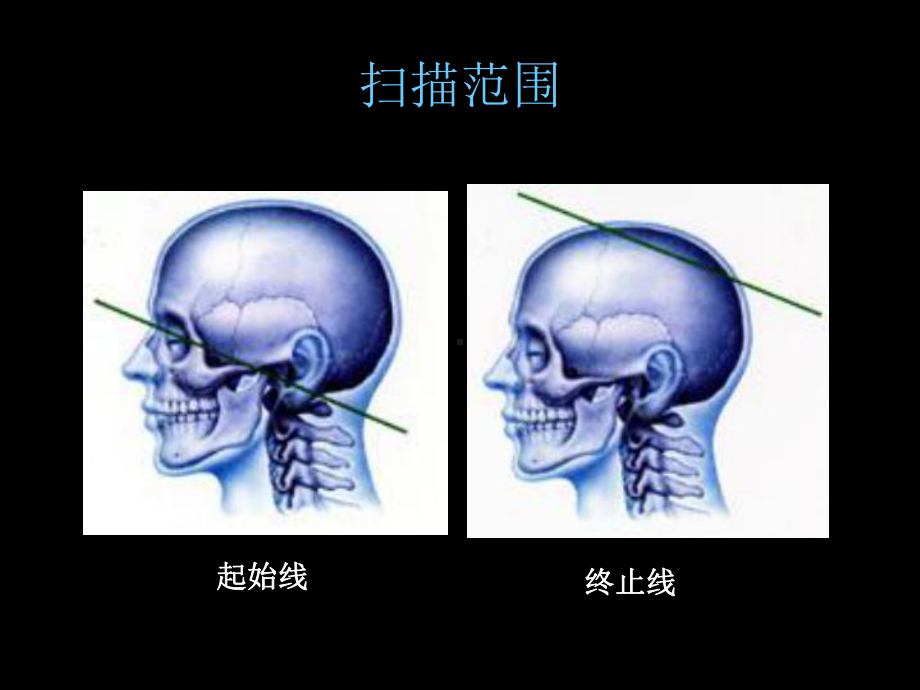 最新CT影像教学片—实验课件.ppt_第2页