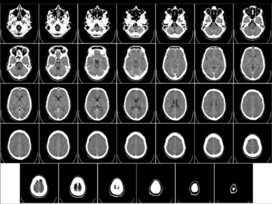 最新CT影像教学片—实验课件.ppt_第3页