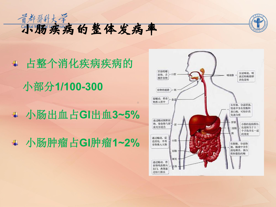 小肠疾病的诊断程序课件.ppt_第3页