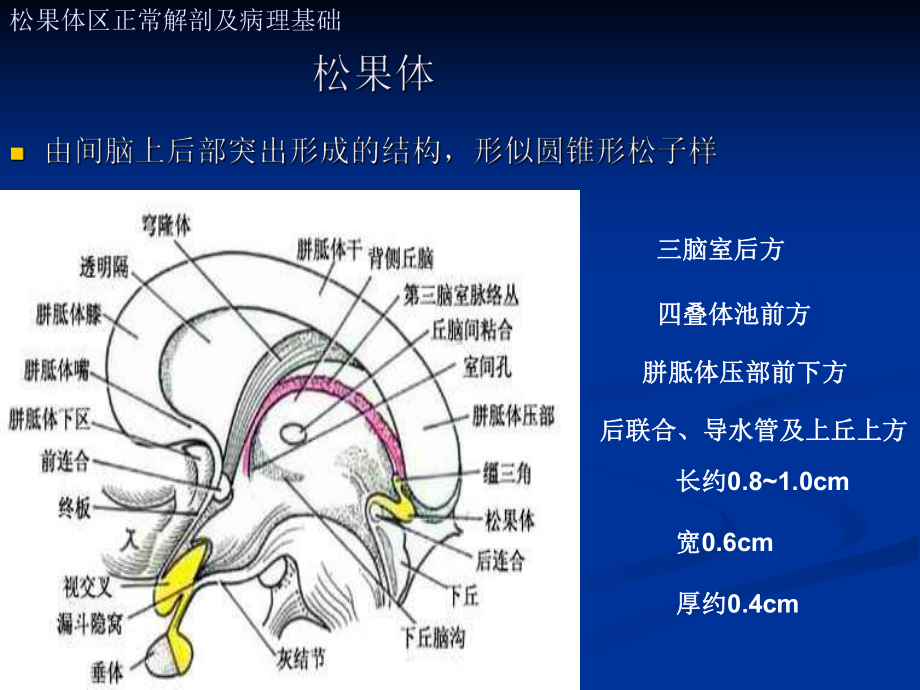 松果体区肿瘤的影像诊断课件.ppt_第2页