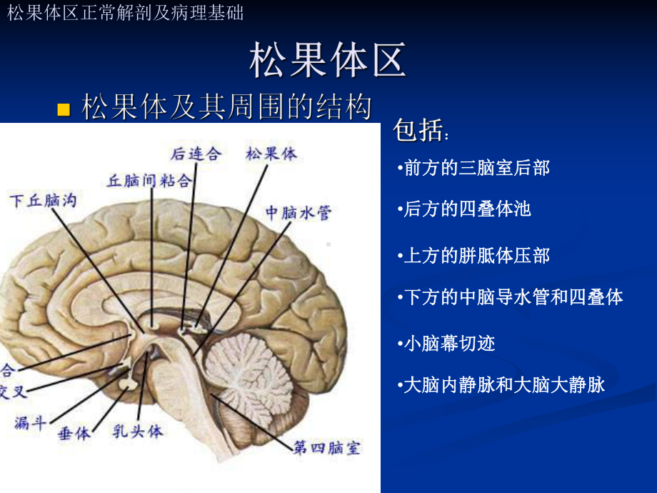 松果体区肿瘤的影像诊断课件.ppt_第3页