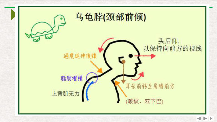 深分析乌龟脖颈椎病运动康复最新版课件.pptx_第1页