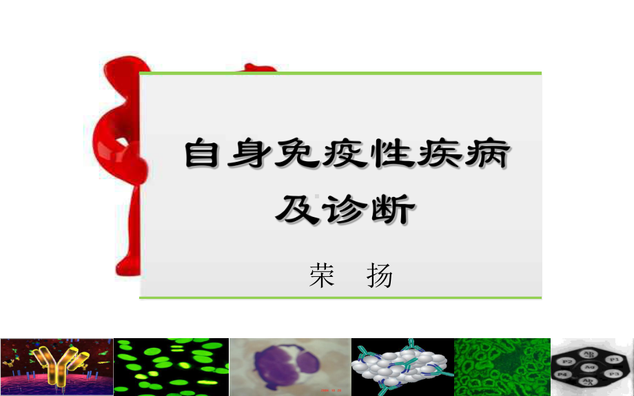 最新自身免疫性疾病及诊断课件.ppt_第1页