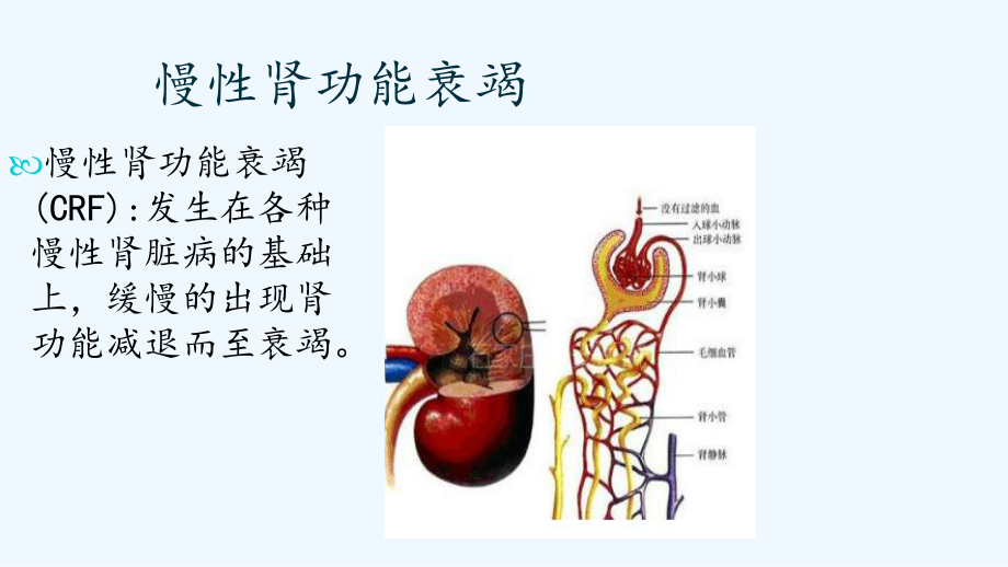 慢性肾功能衰竭护理查房(同名1196)课件.ppt_第3页