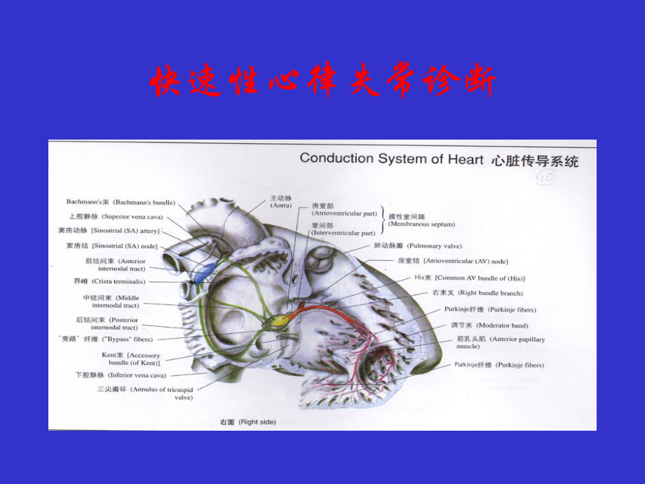 快速性心律失常诊断及治疗急诊科课件.ppt_第2页