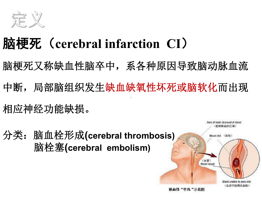 最新1脑梗塞的护理课件.ppt_第3页