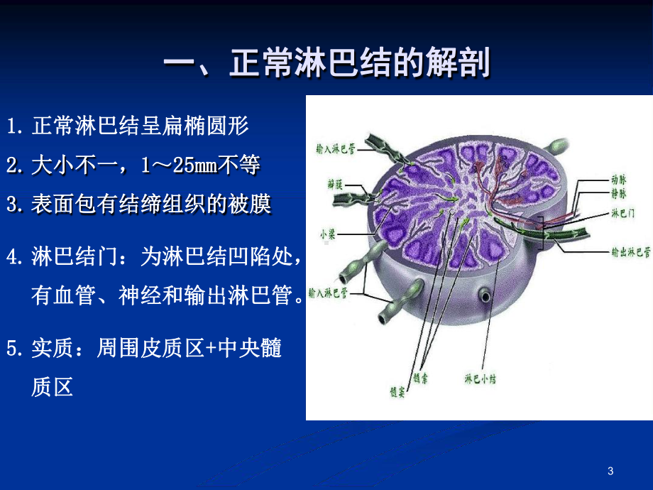 浅表淋巴结超声诊断教学课件.ppt_第3页