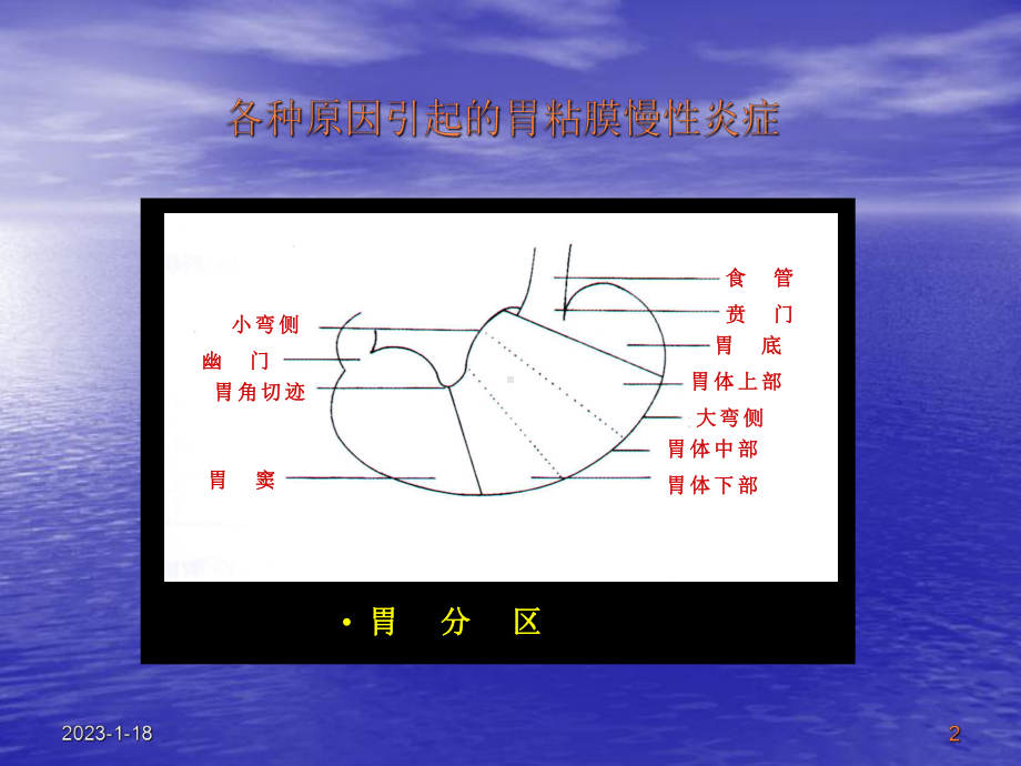 慢性胃炎定课件.ppt_第2页