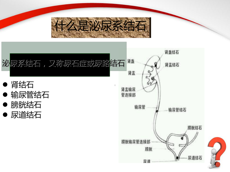 泌尿系结石健康教育(同名20)课件.ppt_第3页