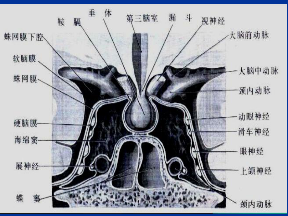 海绵窦综合征课件(同名1224).ppt_第3页