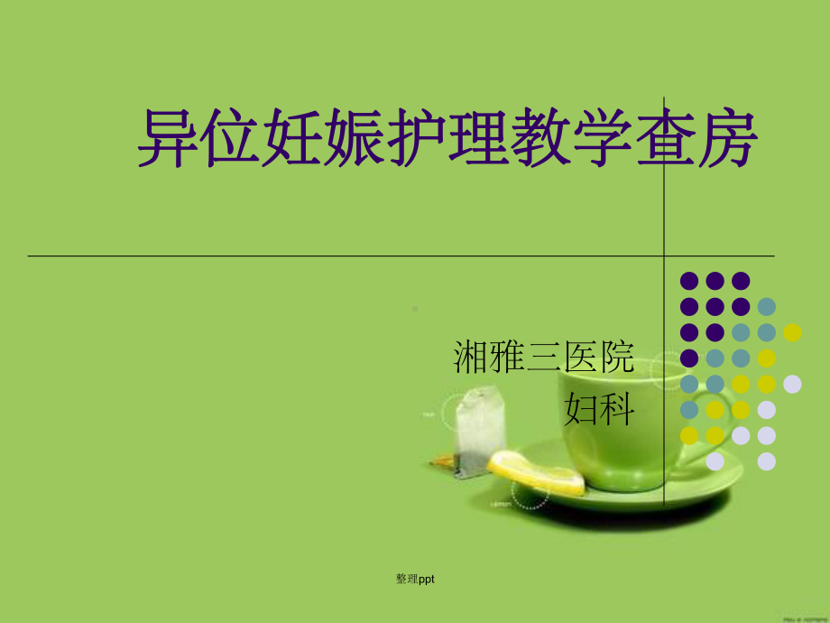 异位妊娠护理教学查房课件.ppt_第1页