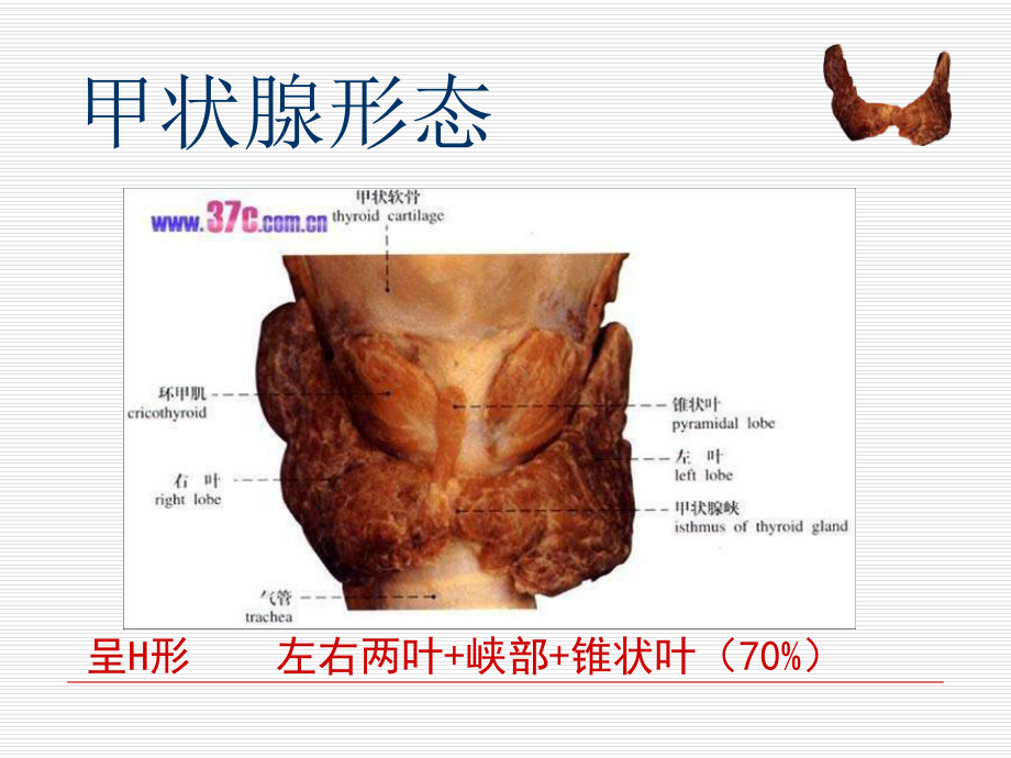 甲状腺肿瘤的护理课件(同名1238).ppt_第2页