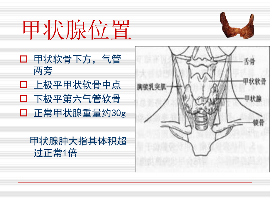 甲状腺肿瘤的护理课件(同名1238).ppt_第3页