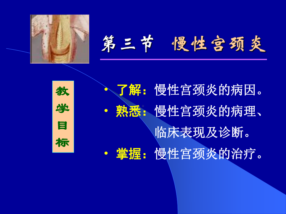 慢性宫颈炎的病理课件.ppt_第1页