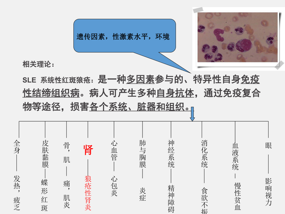 狼疮性肾炎护理查房课件整理.ppt_第3页