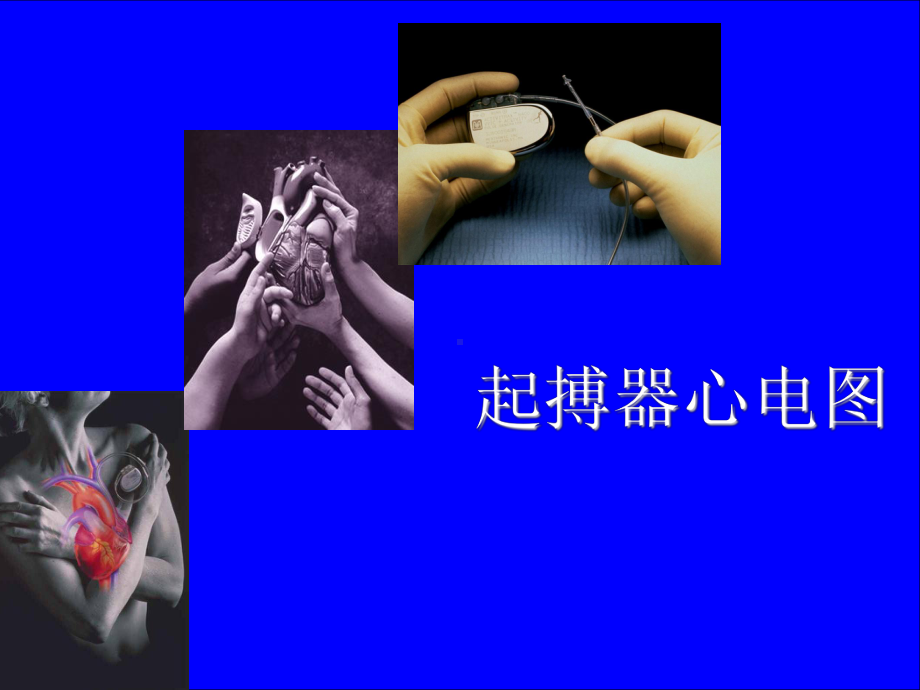 常见起搏器心电图课件.ppt_第1页