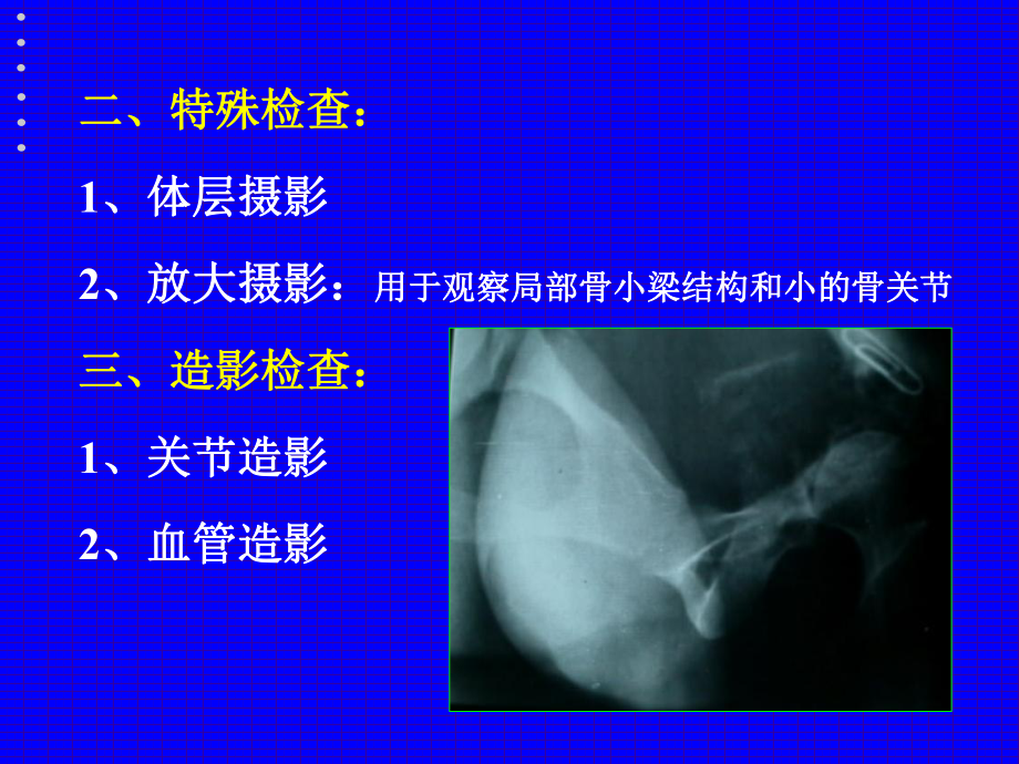 推拿学基础—骨关节影像诊断课件.pptx_第3页